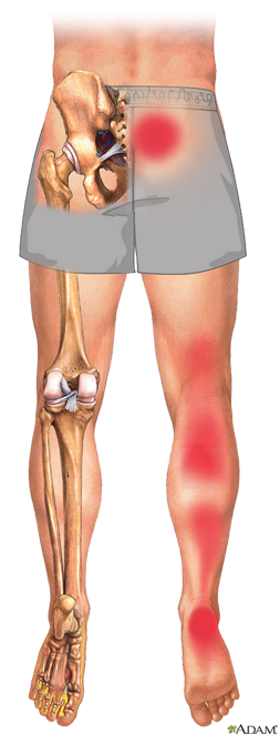 pain relief class, online class to relieve pain in hip and leg
